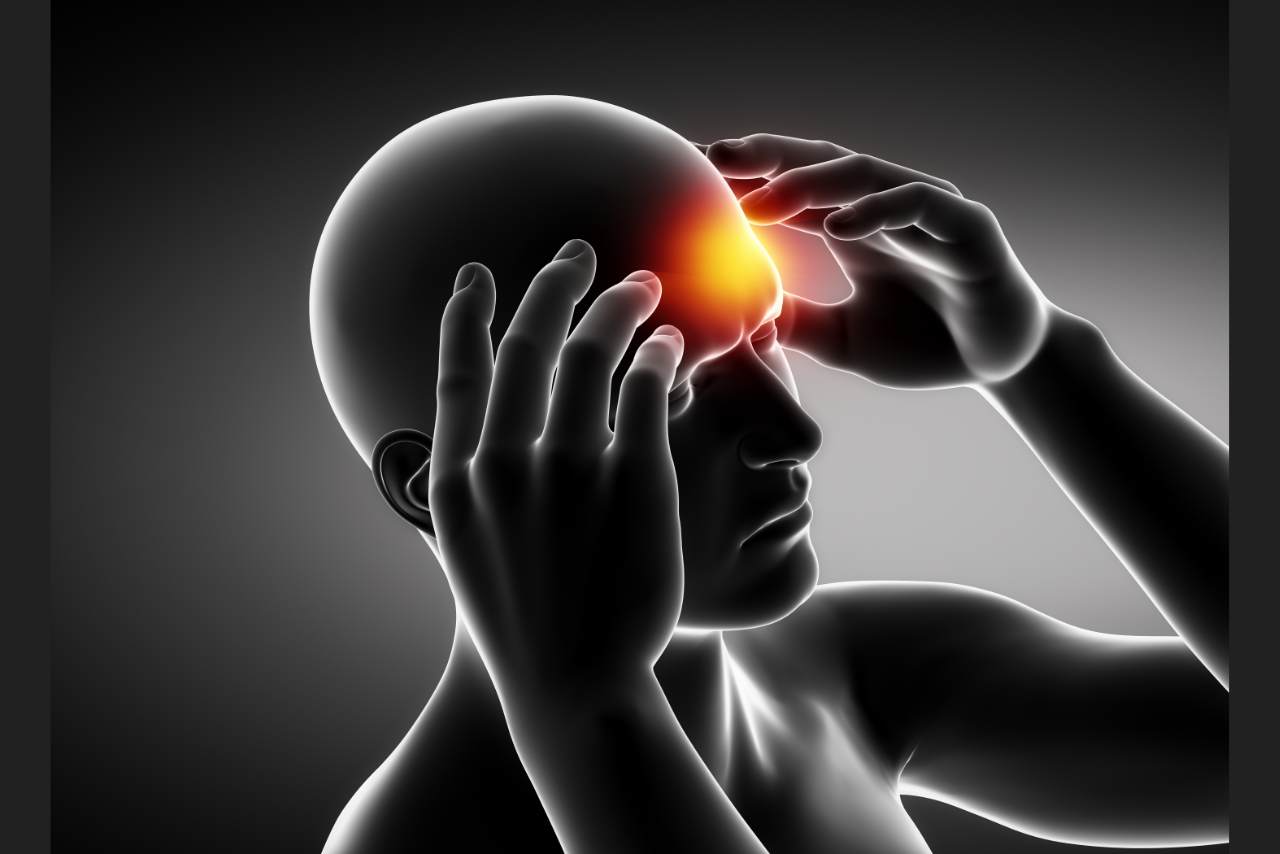 Cervicogenic Headache