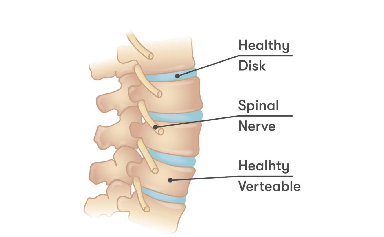 Thoracic Discogenic Pain