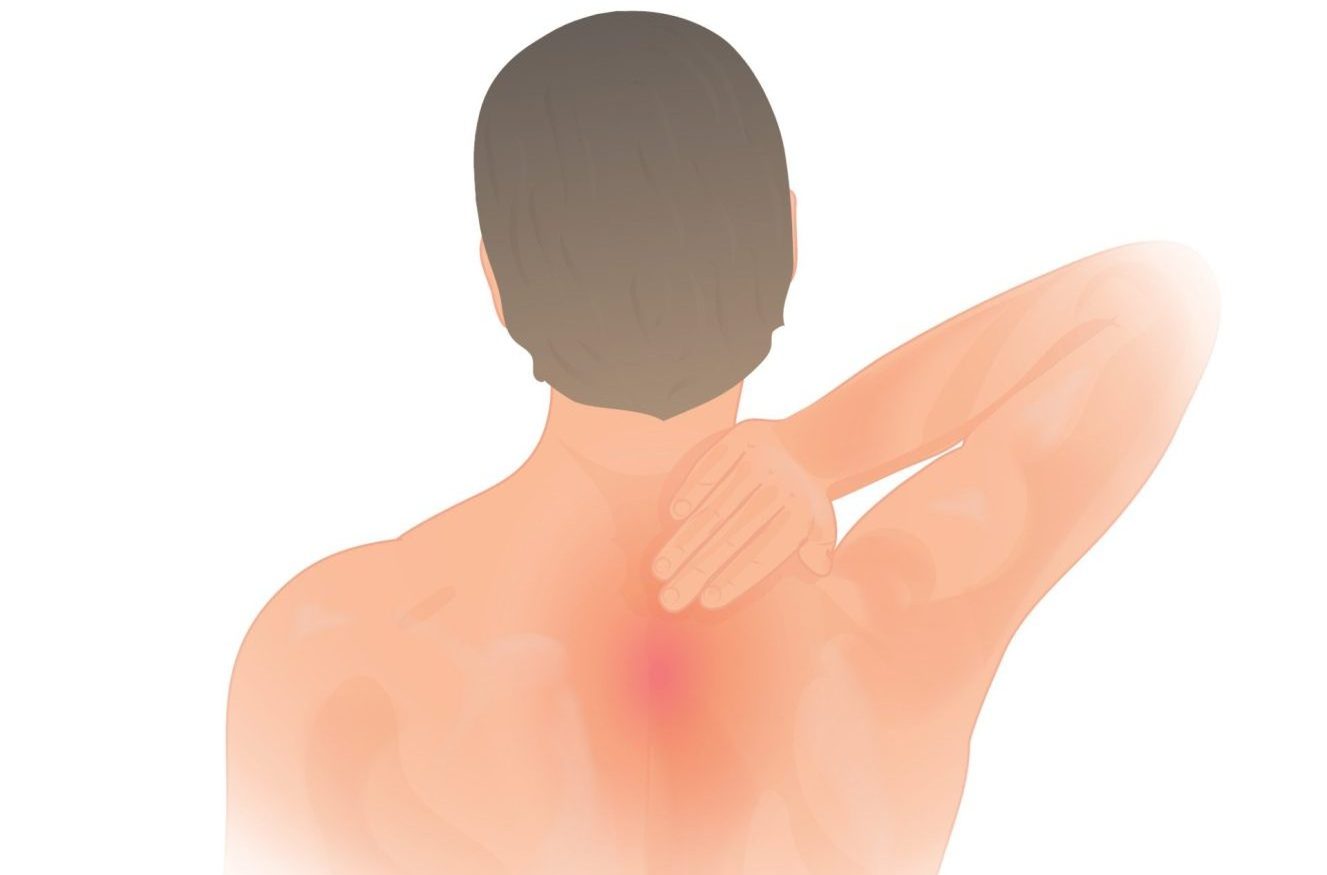 Thoracic Pain Referred from the Neck