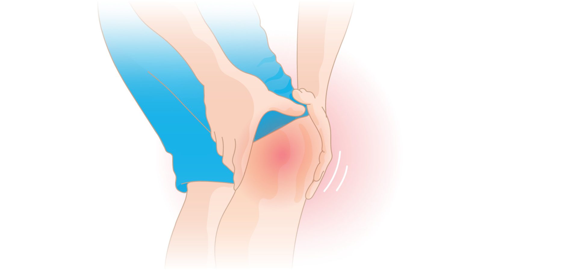 Osgood-Schlatter Disease (OSD)