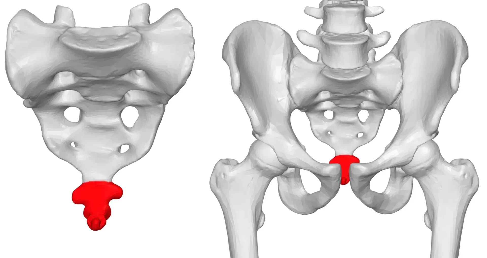 Coccydynia/Tailbone Pain